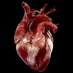 Vorhofflimmern ist eine wichtige Ursache für den sogenannten<br>embolischen Schlaganfall unbestimmter Ursache